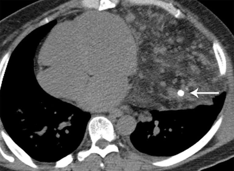 https://cdn.ncbi.nlm.nih.gov/pmc/blobs/600a/10493620/a454da412ca9/med-07-27-f7.jpg