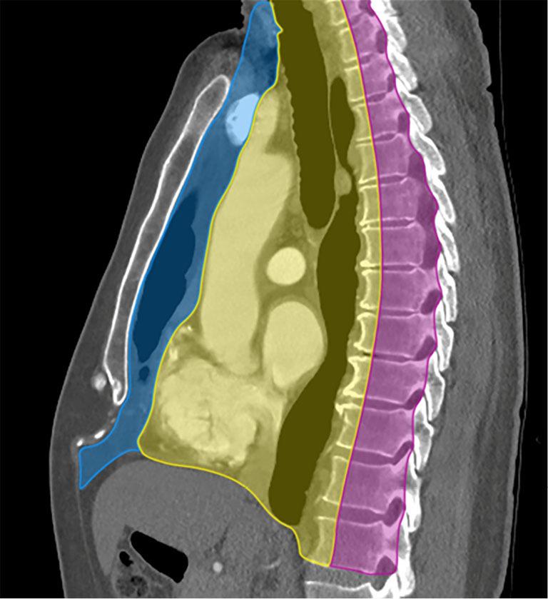 https://cdn.ncbi.nlm.nih.gov/pmc/blobs/600a/10493620/d468b862a391/med-07-27-f1.jpg
