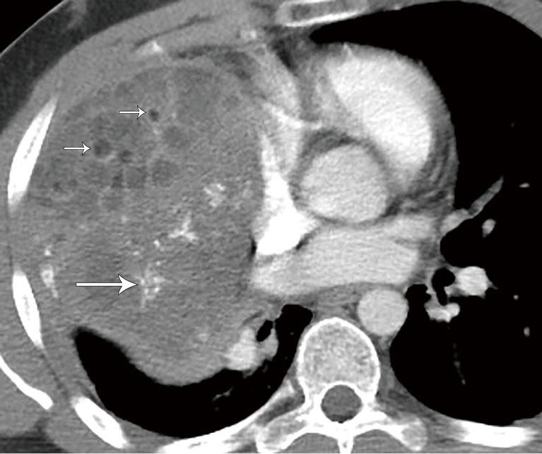 https://cdn.ncbi.nlm.nih.gov/pmc/blobs/600a/10493620/d661551f6c16/med-07-27-f5.jpg