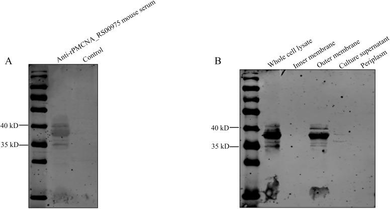 https://cdn.ncbi.nlm.nih.gov/pmc/blobs/600f/11518796/8b46ff038fd0/fcimb-14-1469304-g003.jpg