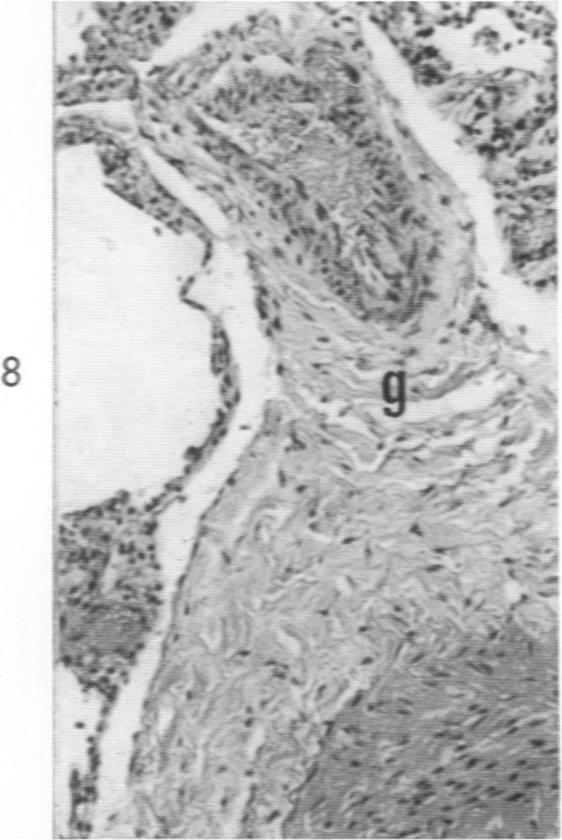 https://cdn.ncbi.nlm.nih.gov/pmc/blobs/600f/1942376/cae7079345d4/amjpathol00332-0098-b.jpg