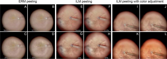 https://cdn.ncbi.nlm.nih.gov/pmc/blobs/6010/9935873/4b0ac4407dfe/41598_2023_29882_Fig5_HTML.jpg