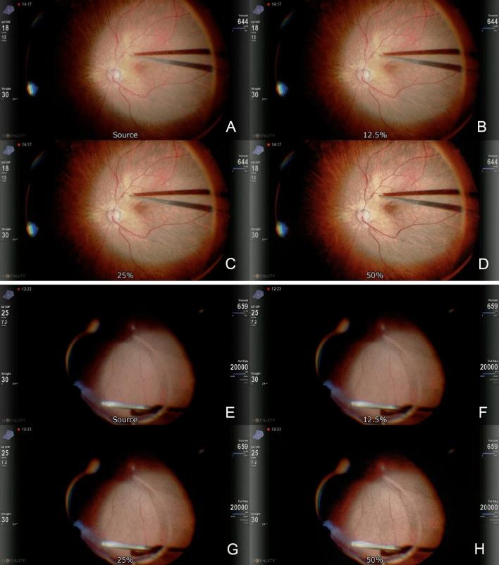 https://cdn.ncbi.nlm.nih.gov/pmc/blobs/6010/9935873/72a42ebbd260/41598_2023_29882_Fig4_HTML.jpg