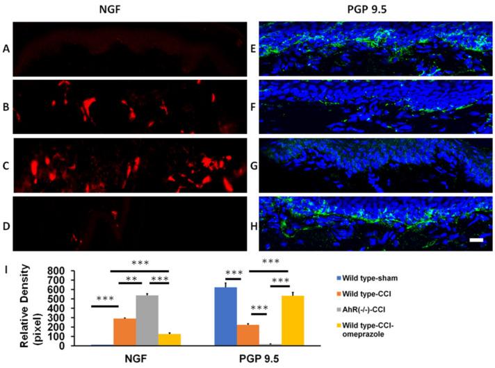 https://cdn.ncbi.nlm.nih.gov/pmc/blobs/6012/9570158/e2c54205b939/ijms-23-11255-g007.jpg