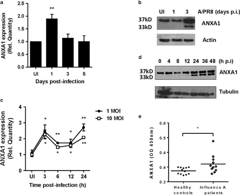 https://cdn.ncbi.nlm.nih.gov/pmc/blobs/601b/4946891/8622967012bf/cdd201619f3.jpg
