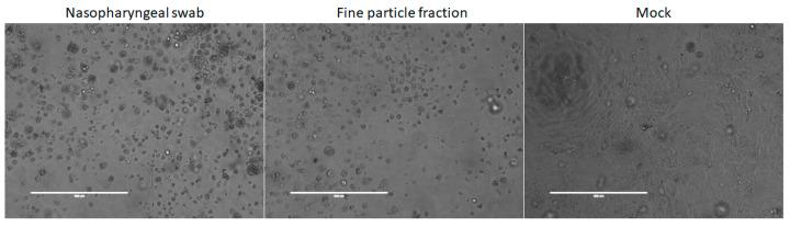 https://cdn.ncbi.nlm.nih.gov/pmc/blobs/601c/10612062/a9cdab05fd48/viruses-15-02033-g002.jpg