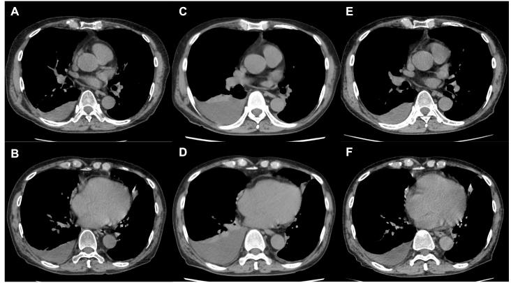https://cdn.ncbi.nlm.nih.gov/pmc/blobs/601e/5564666/4356b5de3f98/oncotarget-08-48521-g001.jpg