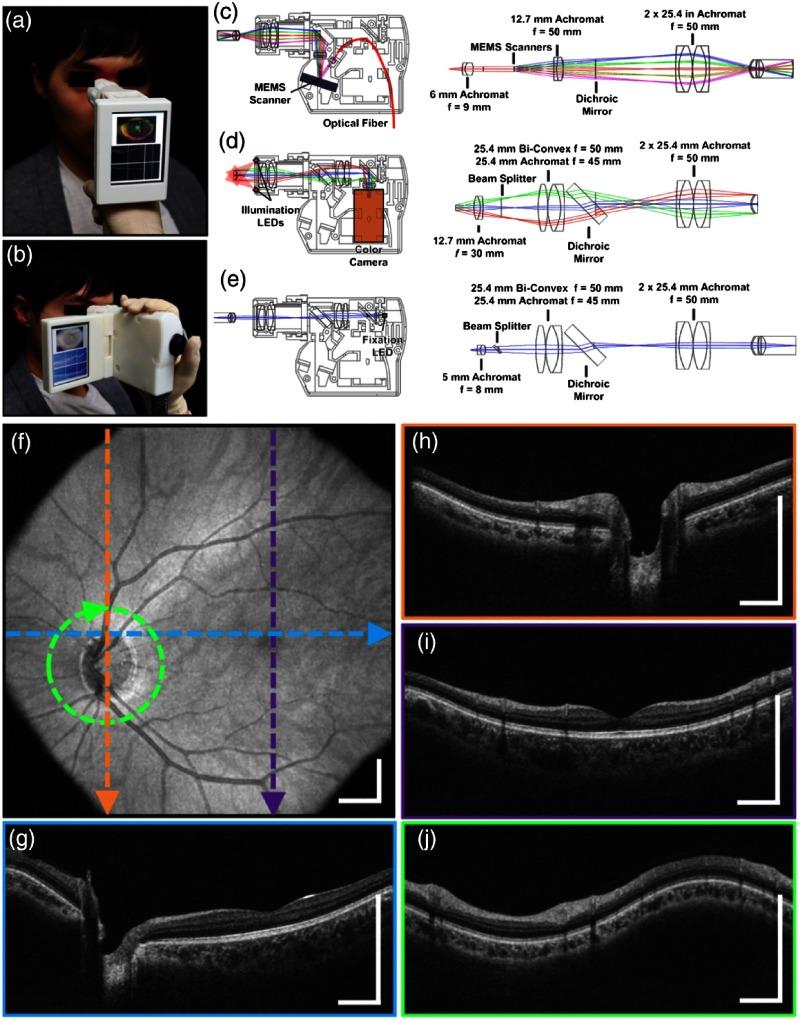 https://cdn.ncbi.nlm.nih.gov/pmc/blobs/6022/5735247/118e5ce169d5/JBO-022-121715-g014.jpg