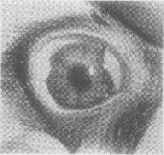 https://cdn.ncbi.nlm.nih.gov/pmc/blobs/6023/1323874/284d9bccdc5d/brjopthal01150-0028-d.jpg