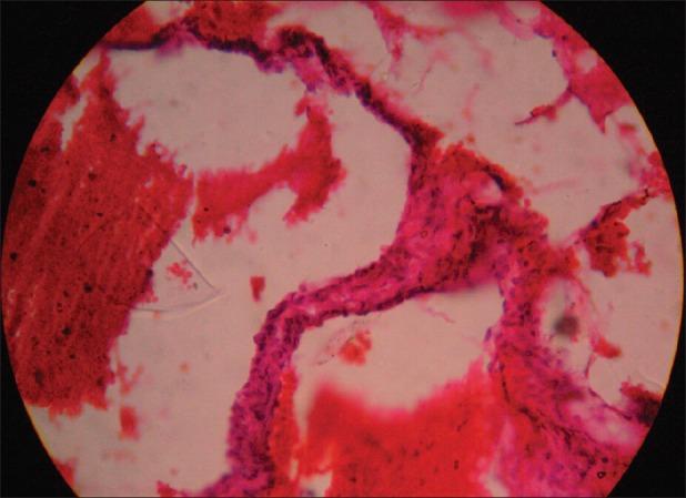 https://cdn.ncbi.nlm.nih.gov/pmc/blobs/6024/3884943/8ecfda036dcc/IJD-59-98-g003.jpg