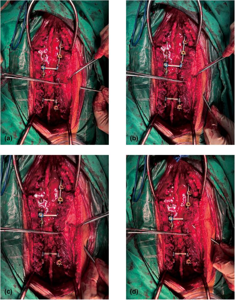 https://cdn.ncbi.nlm.nih.gov/pmc/blobs/6029/12130775/3adc196df08b/j_med-2025-1211-fig002.jpg