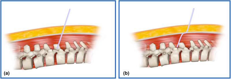 https://cdn.ncbi.nlm.nih.gov/pmc/blobs/6029/12130775/c59d82c49fb1/j_med-2025-1211-fig001.jpg