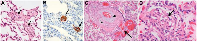 https://cdn.ncbi.nlm.nih.gov/pmc/blobs/602a/7958998/3f108272231b/TACG-14-113-g0001.jpg