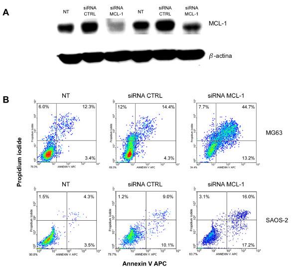 https://cdn.ncbi.nlm.nih.gov/pmc/blobs/6043/2804605/eaf9de868c1c/1476-4598-8-118-4.jpg
