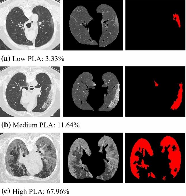 https://cdn.ncbi.nlm.nih.gov/pmc/blobs/6046/8958480/cd4c58f2269d/11760_2022_2183_Fig5_HTML.jpg