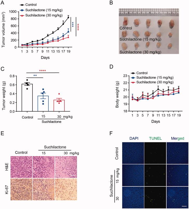 https://cdn.ncbi.nlm.nih.gov/pmc/blobs/604c/8725822/272566435a5d/IPHB_A_2017467_F0007_C.jpg