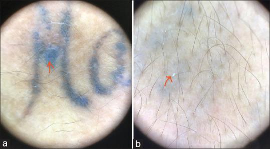 https://cdn.ncbi.nlm.nih.gov/pmc/blobs/6052/10506824/1ce454566f7d/IDOJ-14-585-g008.jpg