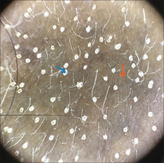 https://cdn.ncbi.nlm.nih.gov/pmc/blobs/6052/10506824/32cf723b384e/IDOJ-14-585-g001.jpg