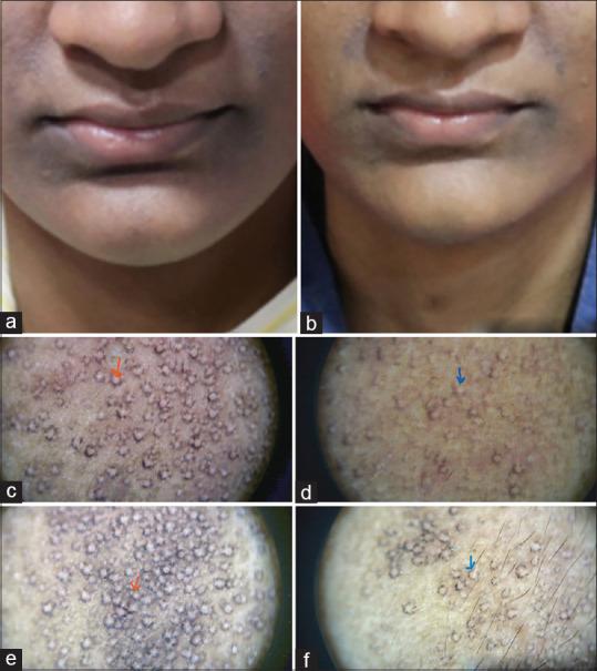 https://cdn.ncbi.nlm.nih.gov/pmc/blobs/6052/10506824/caac966b6246/IDOJ-14-585-g006.jpg