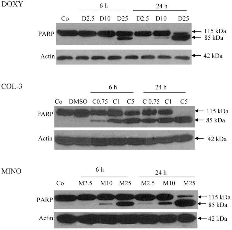 https://cdn.ncbi.nlm.nih.gov/pmc/blobs/6055/4266609/df619756034b/pone.0114457.g006.jpg