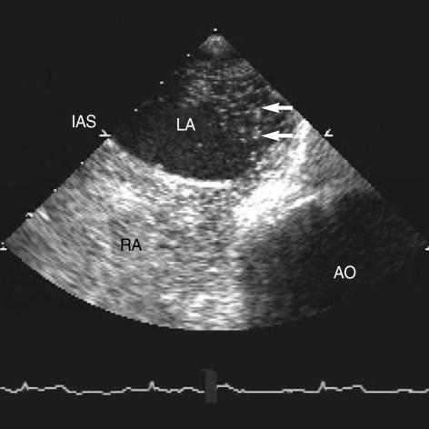 https://cdn.ncbi.nlm.nih.gov/pmc/blobs/6056/2694641/8383451bc475/jkms-22-1071-g002.jpg