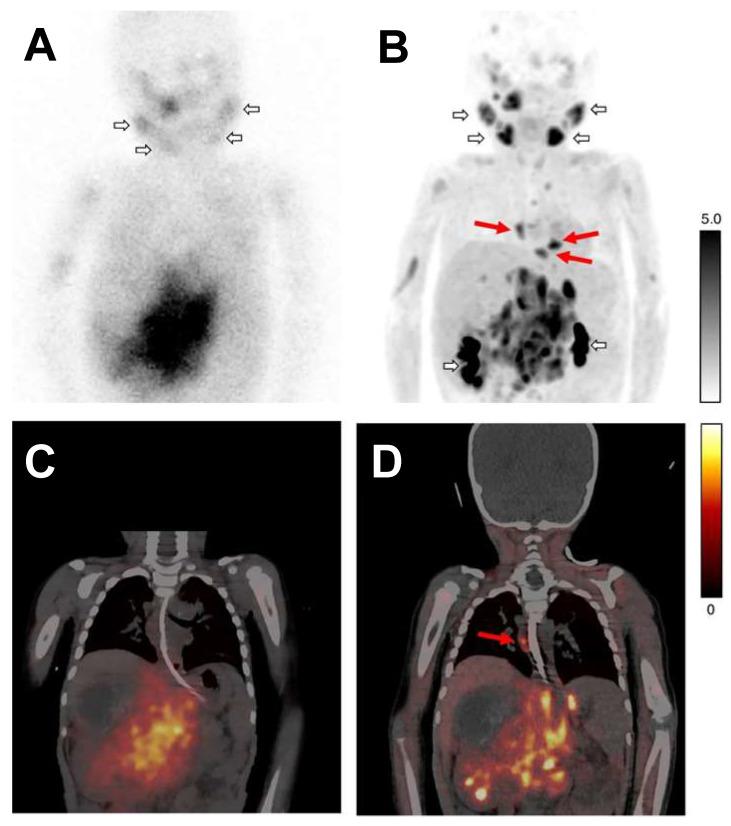 https://cdn.ncbi.nlm.nih.gov/pmc/blobs/6058/11155404/6547e4e5ed37/thnov14p3178g003.jpg