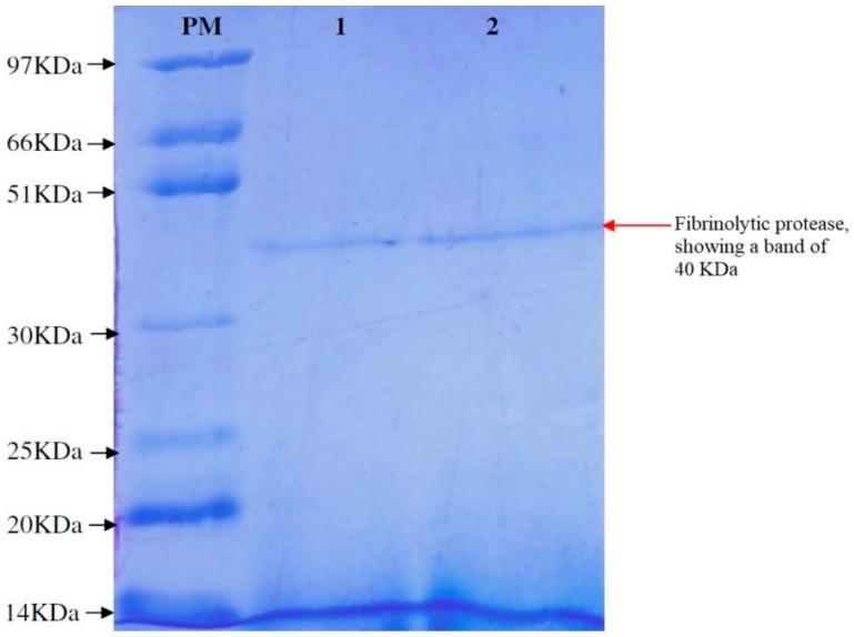 https://cdn.ncbi.nlm.nih.gov/pmc/blobs/6058/7022875/c4cc9ebeefc8/biomolecules-10-00003-g004.jpg