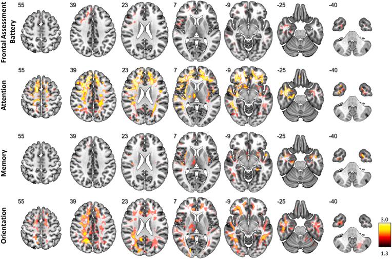 https://cdn.ncbi.nlm.nih.gov/pmc/blobs/605c/12172932/bf6bb8f93b75/gr1.jpg