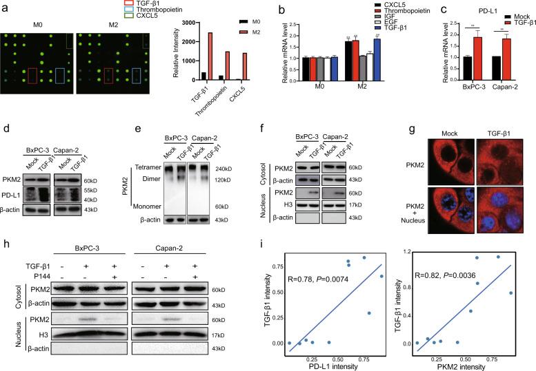 https://cdn.ncbi.nlm.nih.gov/pmc/blobs/605f/8816727/48cb32a4287d/41388_2021_2133_Fig4_HTML.jpg