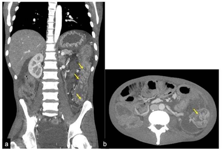 https://cdn.ncbi.nlm.nih.gov/pmc/blobs/605f/9606936/26720967f847/tomography-08-00198-g037.jpg