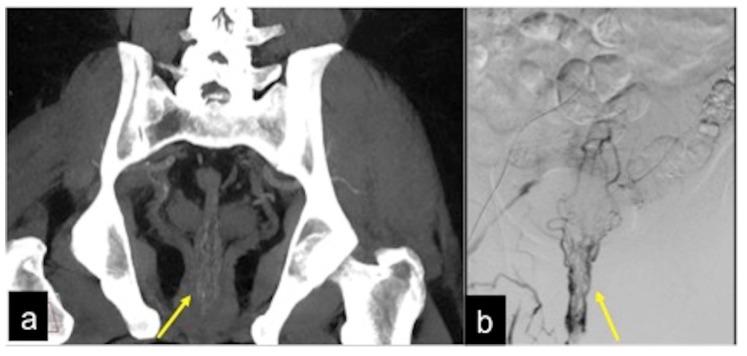https://cdn.ncbi.nlm.nih.gov/pmc/blobs/605f/9606936/5dbb85b69cfb/tomography-08-00198-g017.jpg