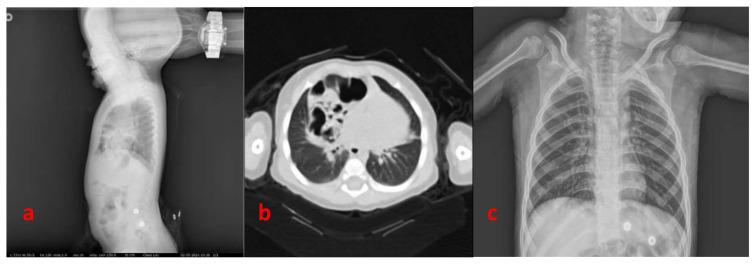 https://cdn.ncbi.nlm.nih.gov/pmc/blobs/6060/11518355/d1b76d63b4da/tjmed-54-05-989f2.jpg