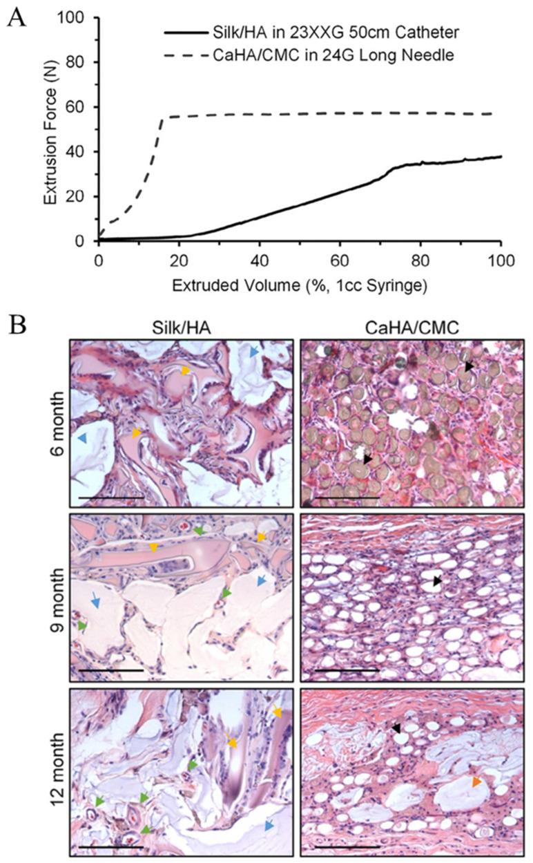 https://cdn.ncbi.nlm.nih.gov/pmc/blobs/6064/10975320/0b7aba1d0aac/pharmaceutics-16-00430-g004.jpg