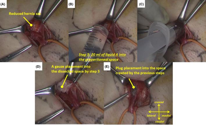 https://cdn.ncbi.nlm.nih.gov/pmc/blobs/6064/7832968/68227ec6758b/AGS3-5-119-g003.jpg