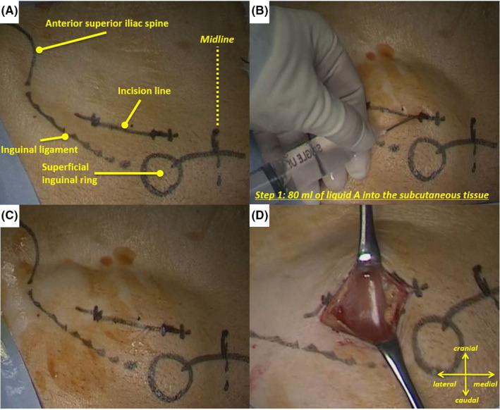https://cdn.ncbi.nlm.nih.gov/pmc/blobs/6064/7832968/d176de3021bb/AGS3-5-119-g001.jpg