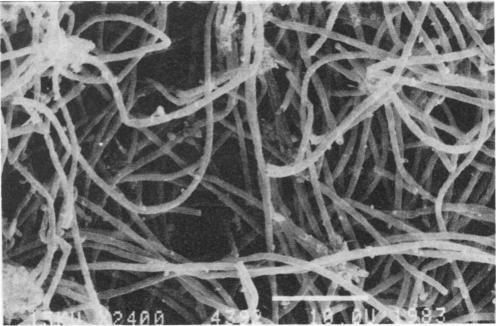 https://cdn.ncbi.nlm.nih.gov/pmc/blobs/6065/241749/8924ccdd2a36/aem00151-0133-b.jpg