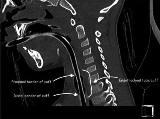 https://cdn.ncbi.nlm.nih.gov/pmc/blobs/6068/8477782/abd7d8b064c1/SJA-15-403-g001.jpg