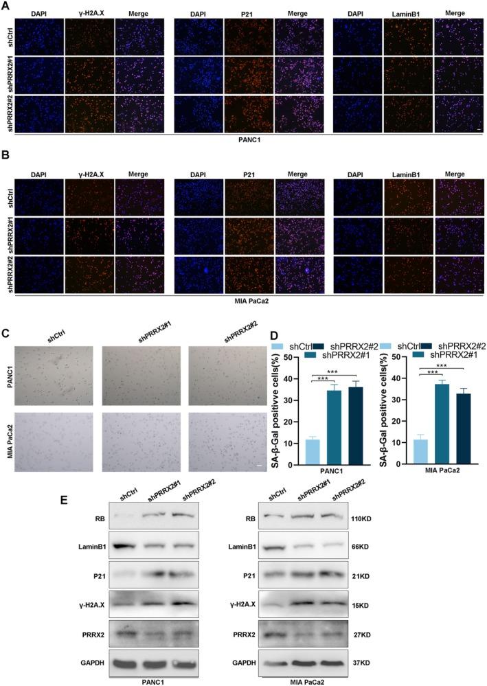 https://cdn.ncbi.nlm.nih.gov/pmc/blobs/6069/12400069/1cc37bc34524/CAS-116-2427-g010.jpg