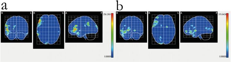 https://cdn.ncbi.nlm.nih.gov/pmc/blobs/606f/4520520/671f02c7d591/pone.0124527.g005.jpg