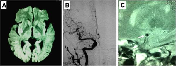 https://cdn.ncbi.nlm.nih.gov/pmc/blobs/6077/3898091/43b6d4c0e018/1471-2377-14-16-1.jpg