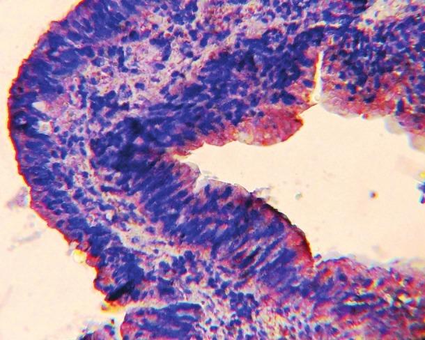 https://cdn.ncbi.nlm.nih.gov/pmc/blobs/6078/3603485/83449fc29ac3/SJG-19-23-g005.jpg