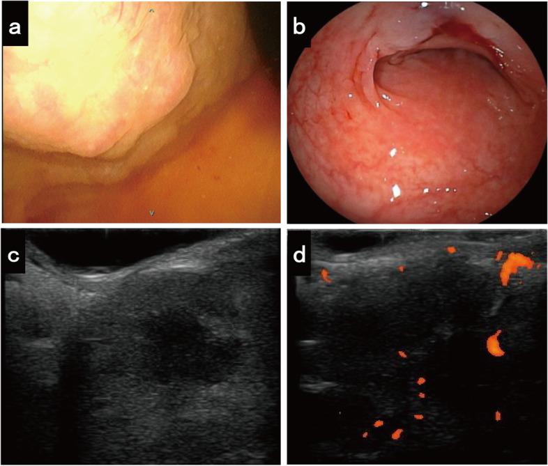 https://cdn.ncbi.nlm.nih.gov/pmc/blobs/607c/9178902/5b538493c71b/12957_2022_2662_Fig2_HTML.jpg