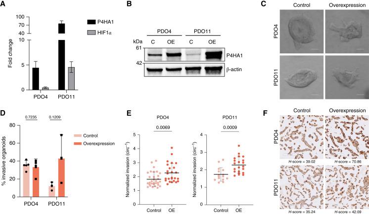 https://cdn.ncbi.nlm.nih.gov/pmc/blobs/607f/12123483/956bbeb540ba/crc-24-0025_f5.jpg