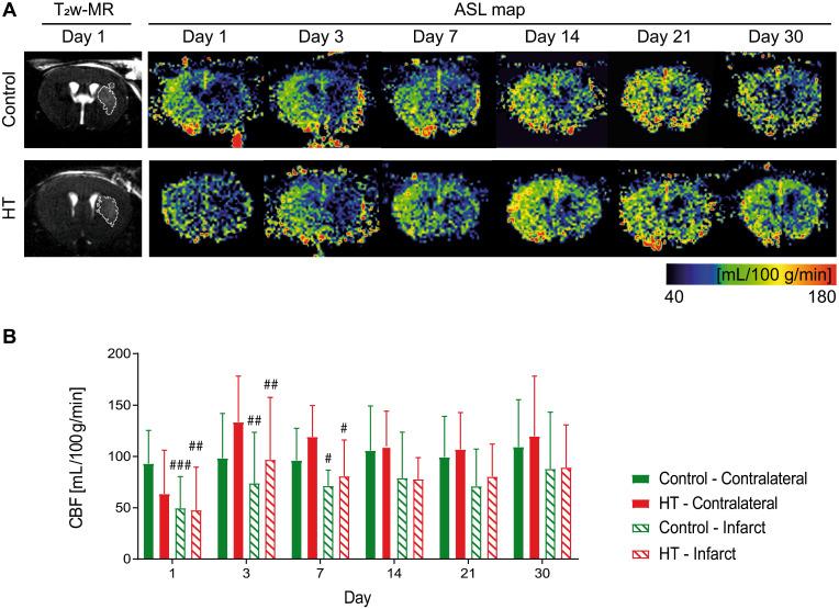 https://cdn.ncbi.nlm.nih.gov/pmc/blobs/6085/7977466/91e088f4669c/thnov11p4030g003.jpg