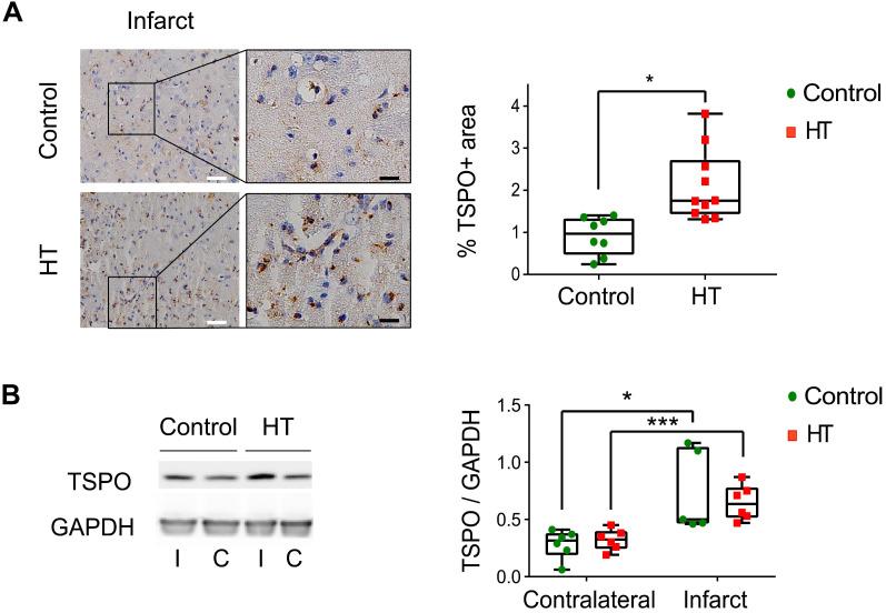 https://cdn.ncbi.nlm.nih.gov/pmc/blobs/6085/7977466/e5d6a8f6d7e5/thnov11p4030g006.jpg
