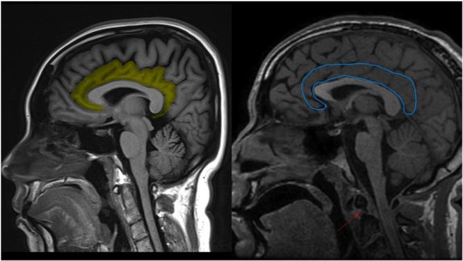 https://cdn.ncbi.nlm.nih.gov/pmc/blobs/608d/11649386/090c147de5ea/IBRA-10-439-g001.jpg