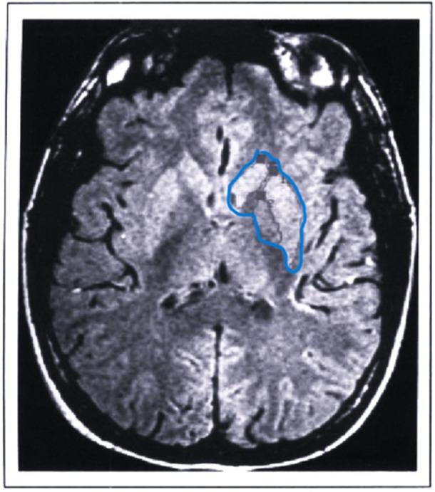 https://cdn.ncbi.nlm.nih.gov/pmc/blobs/608d/11649386/e3ed94e7ff98/IBRA-10-439-g003.jpg