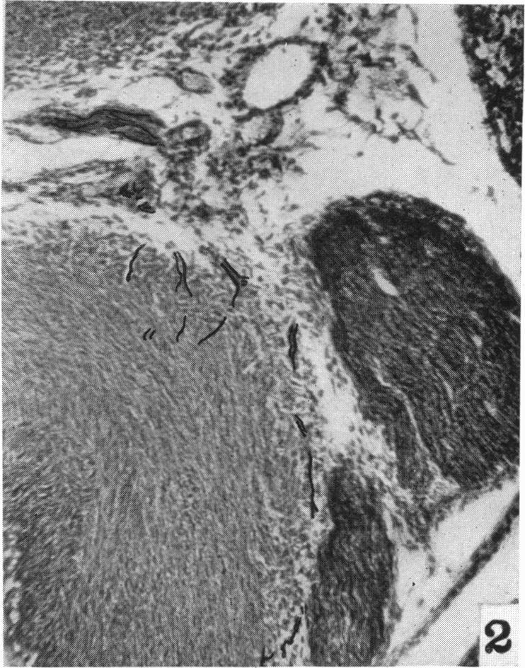 https://cdn.ncbi.nlm.nih.gov/pmc/blobs/6092/1252633/83119a2500e7/janat00517-0097-b.jpg