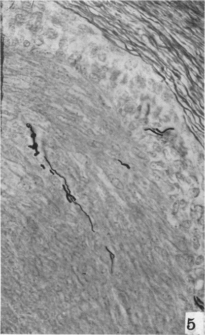 https://cdn.ncbi.nlm.nih.gov/pmc/blobs/6092/1252633/bd3e03240dce/janat00517-0098-a.jpg