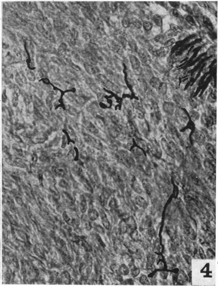 https://cdn.ncbi.nlm.nih.gov/pmc/blobs/6092/1252633/ef42d163b0a0/janat00517-0097-d.jpg